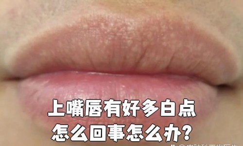 月经期间智齿发炎红肿网—知名的大姨妈智齿发炎超疼网站,分享月经期间智齿发炎肿痛怎么办知识